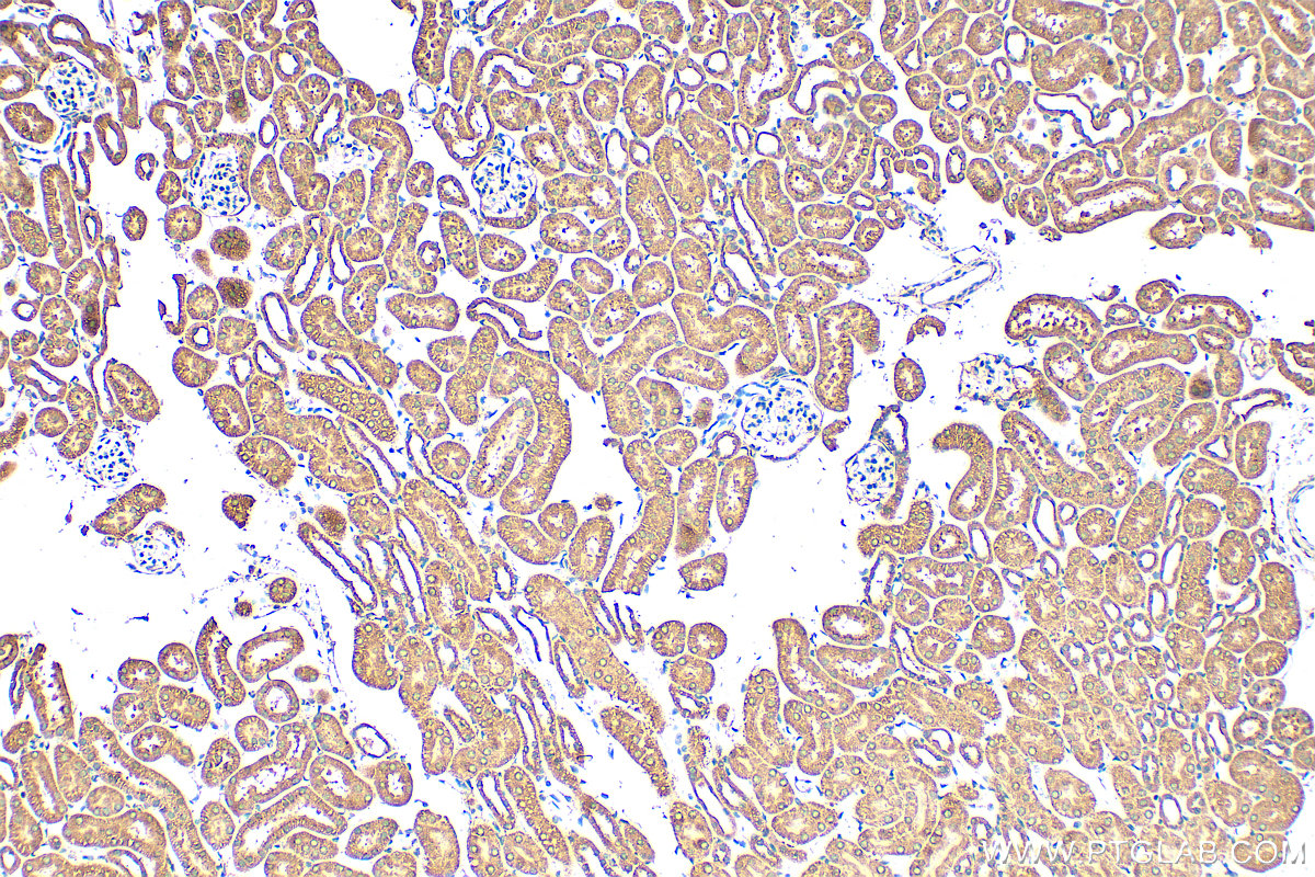 IHC staining of mouse kidney using 21499-1-AP