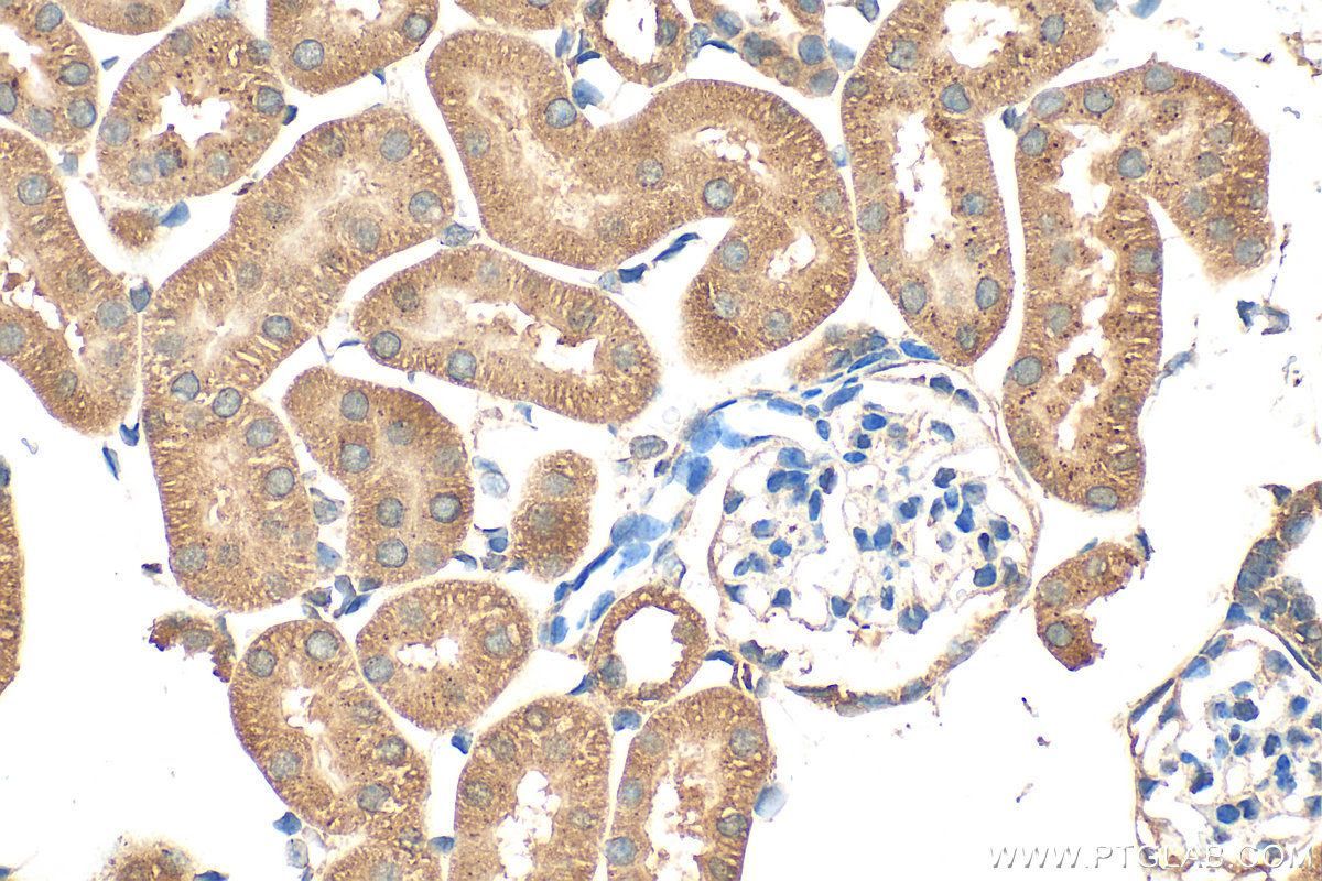 IHC staining of mouse kidney using 21499-1-AP