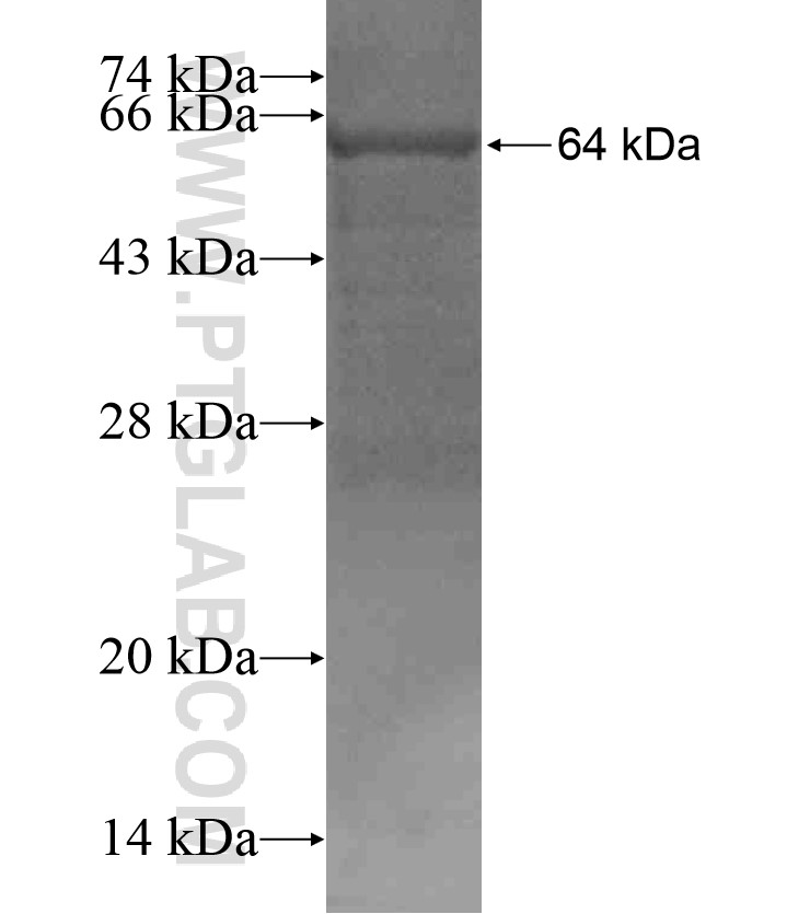 SH3D20 fusion protein Ag18317 SDS-PAGE SH3D20 fusion protein Ag18317 SDS-PAGE
