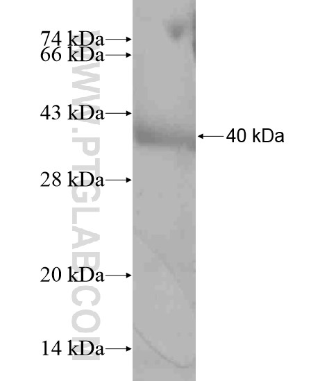 SH3D20 fusion protein Ag19405 SDS-PAGE SH3D20 fusion protein Ag19405 SDS-PAGE