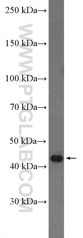 WB analysis of rat brain using 27014-1-AP