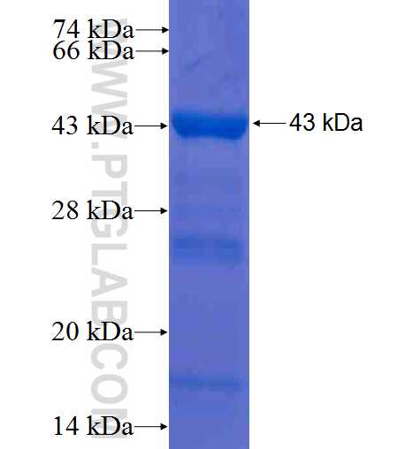 SH3GLB1 fusion protein Ag7949 SDS-PAGE SH3GLB1 fusion protein Ag7949 SDS-PAGE