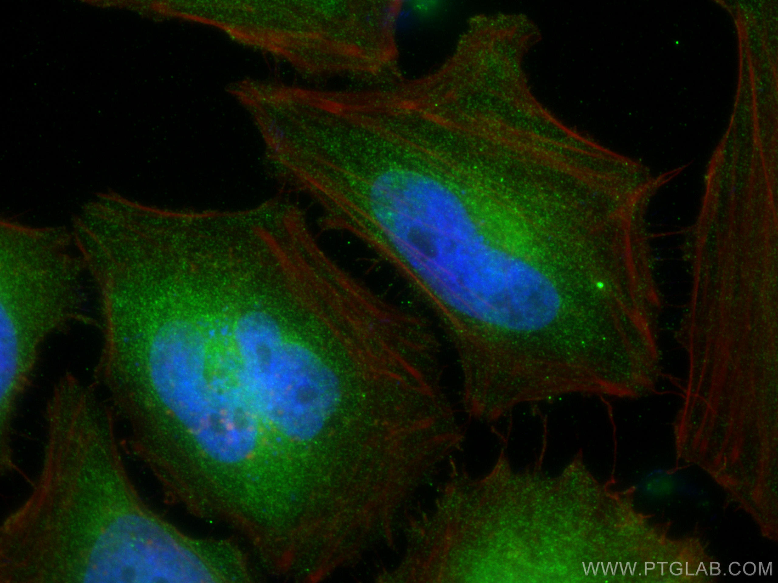 IF Staining of HeLa using 68325-1-Ig