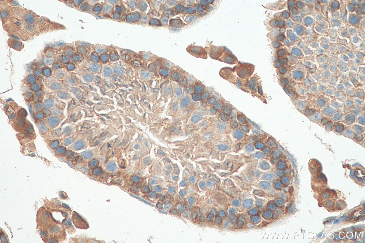 IHC staining of mouse testis using 68325-1-Ig