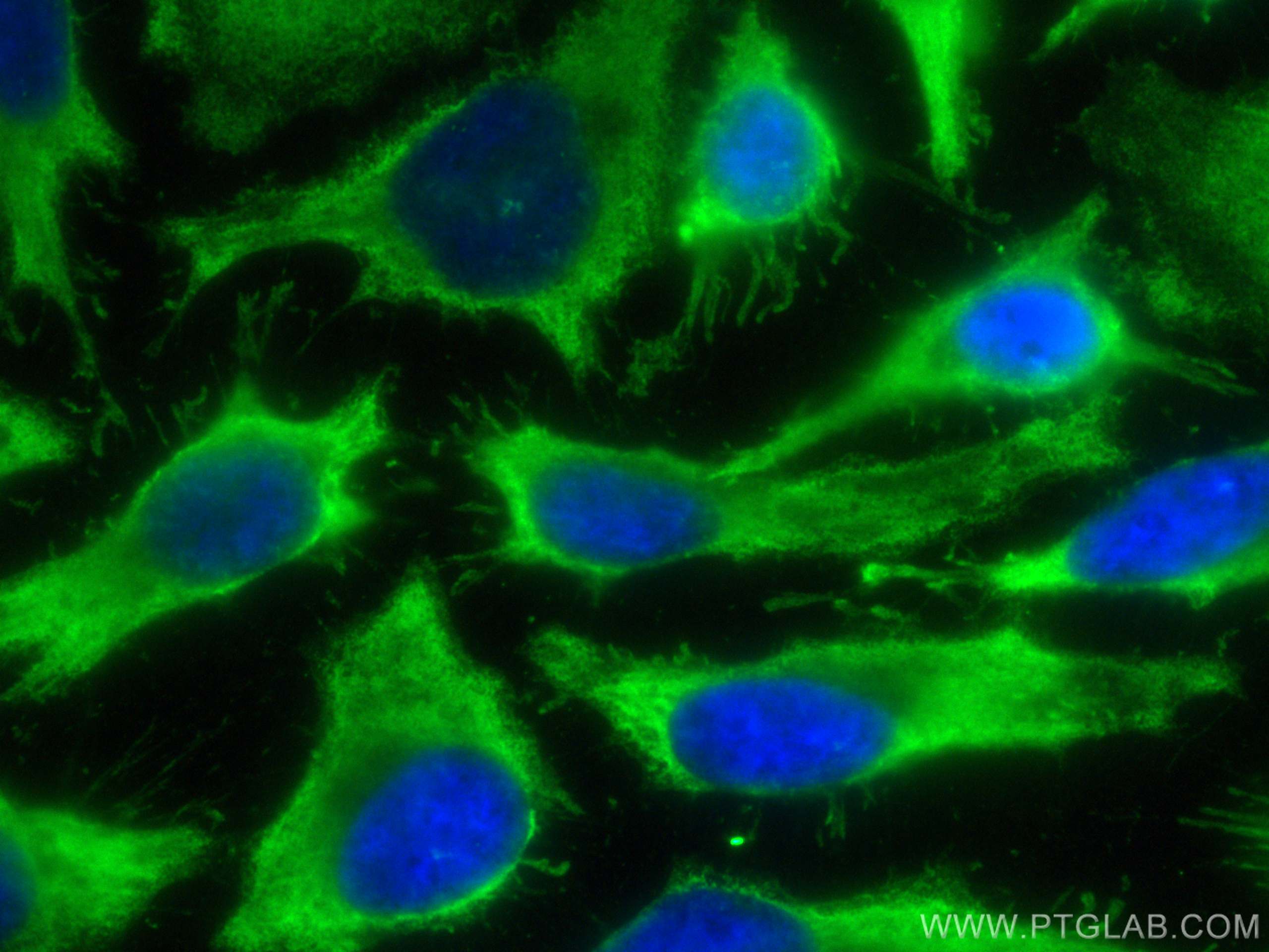 IF Staining of HeLa using CL488-68325