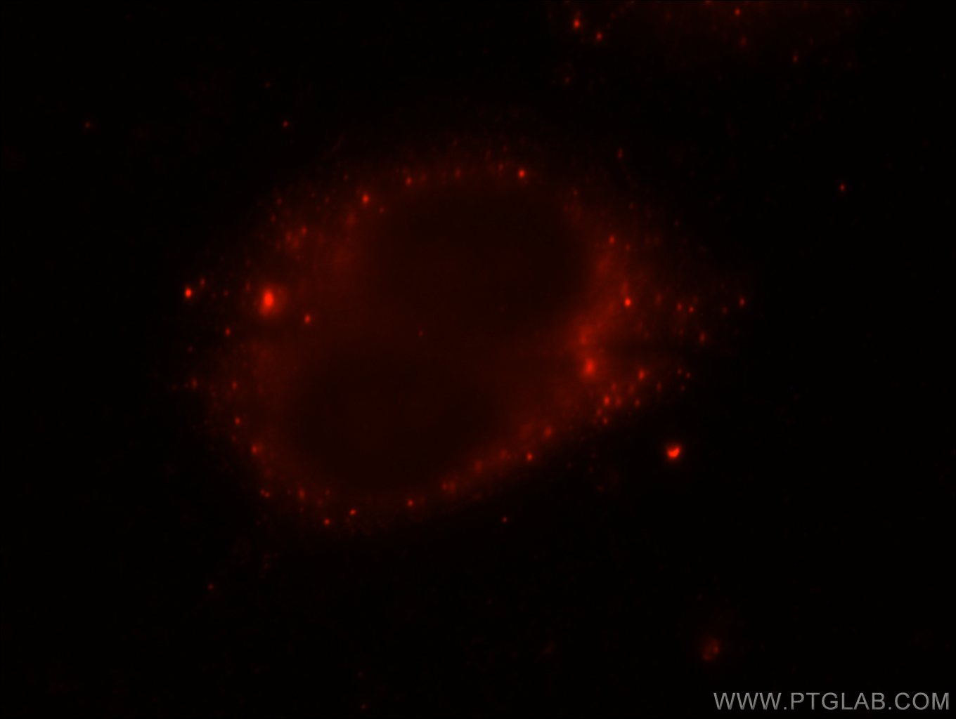 IF Staining of HepG2 using 18976-1-AP