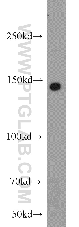 SH3PXD2A Polyclonal antibody