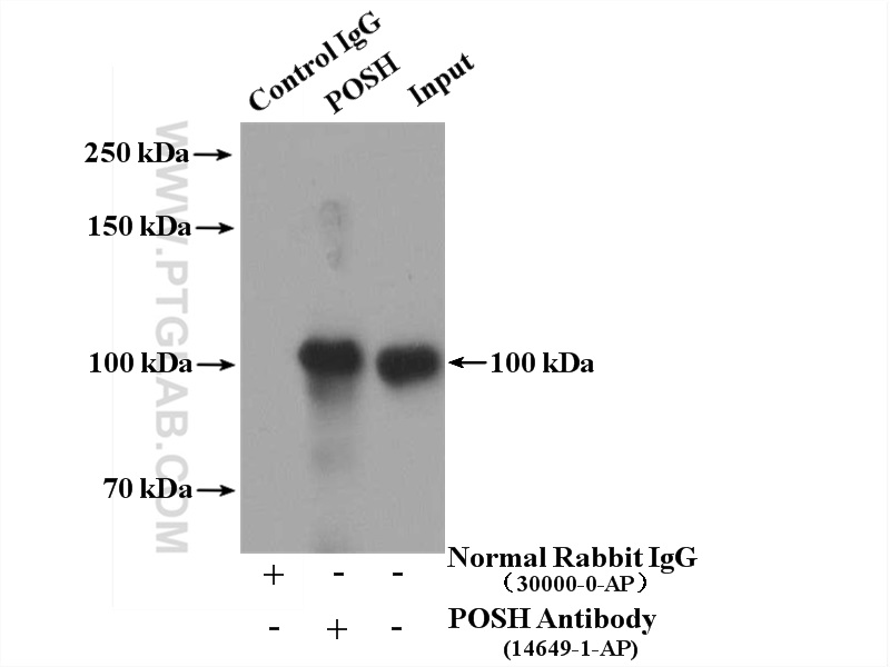 IP experiment of mouse brain using 14649-1-AP