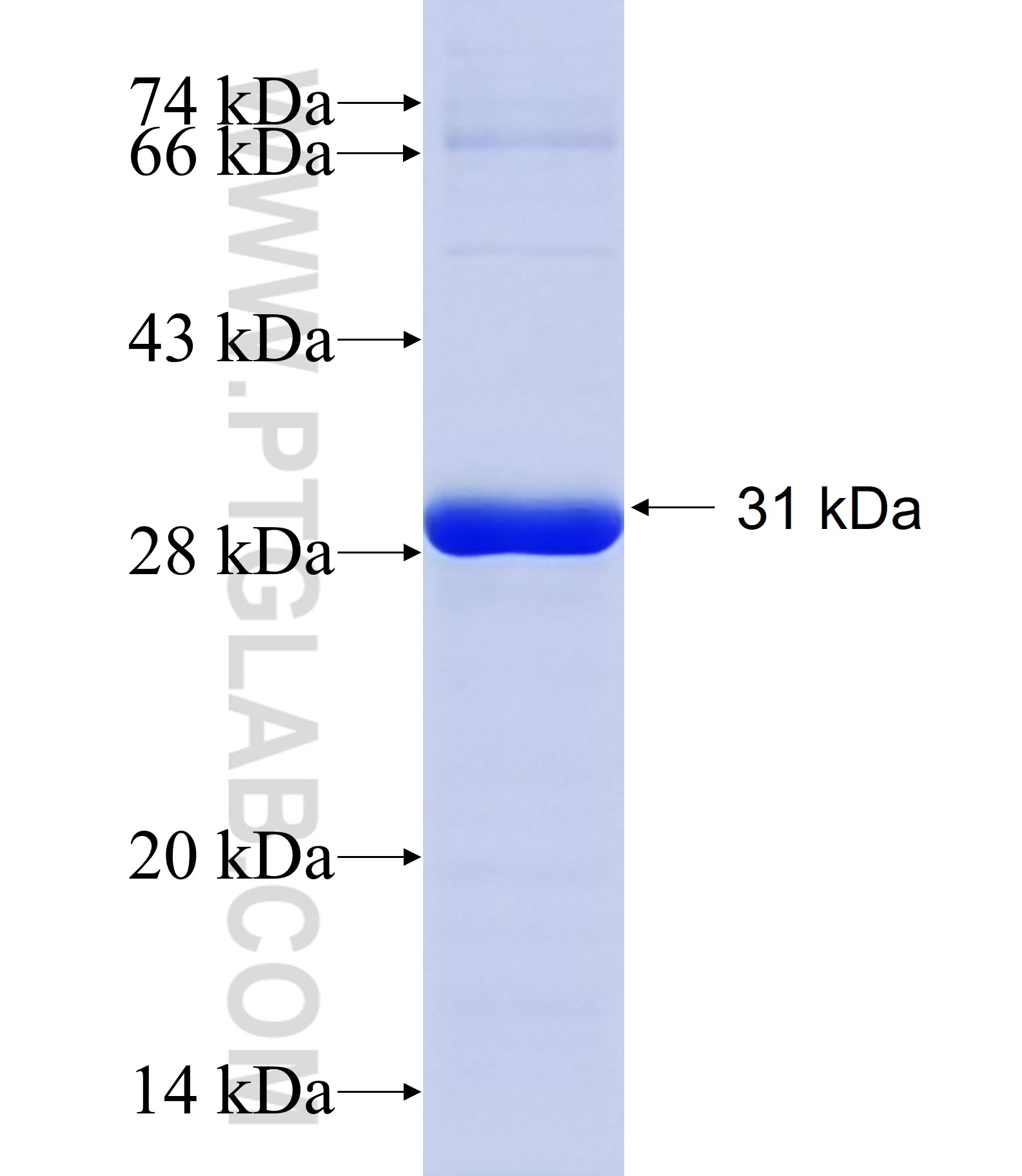 SH3RF2 fusion protein Ag29678 SDS-PAGE SH3RF2 fusion protein Ag29678 SDS-PAGE