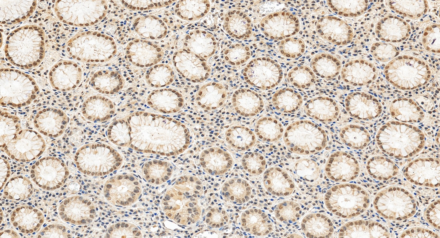 IHC staining of human stomach using 55373-1-AP (same clone as 55373-1-PBS)