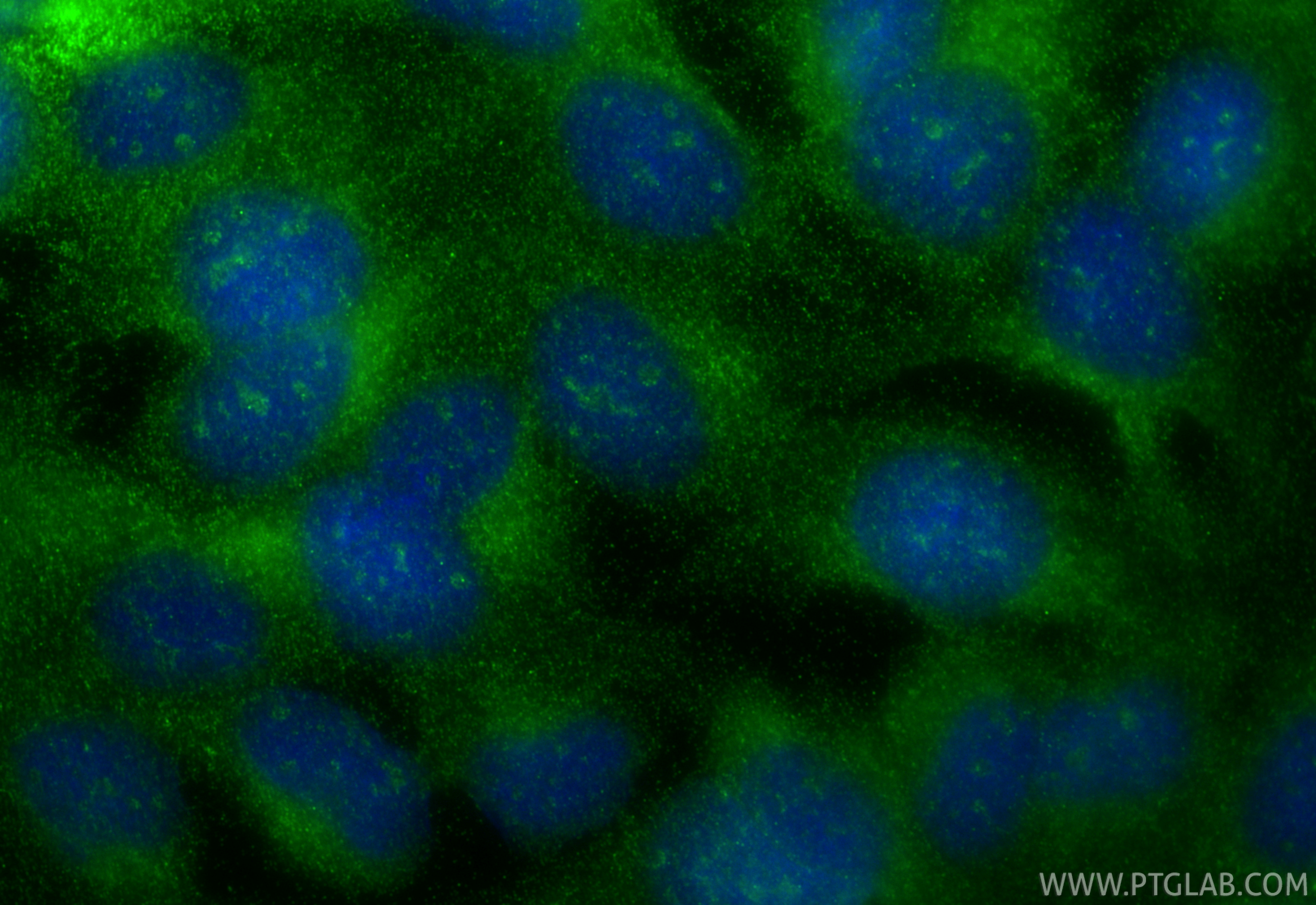 IF Staining of U2OS using 27905-1-AP (same clone as 27905-1-PBS)