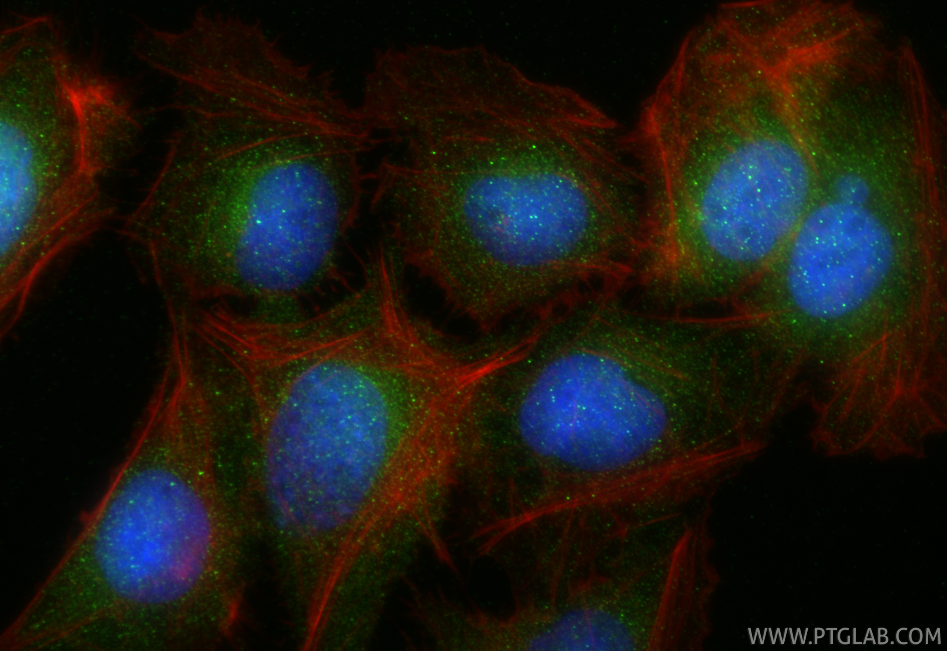 IF Staining of U2OS using 27905-1-AP (same clone as 27905-1-PBS)