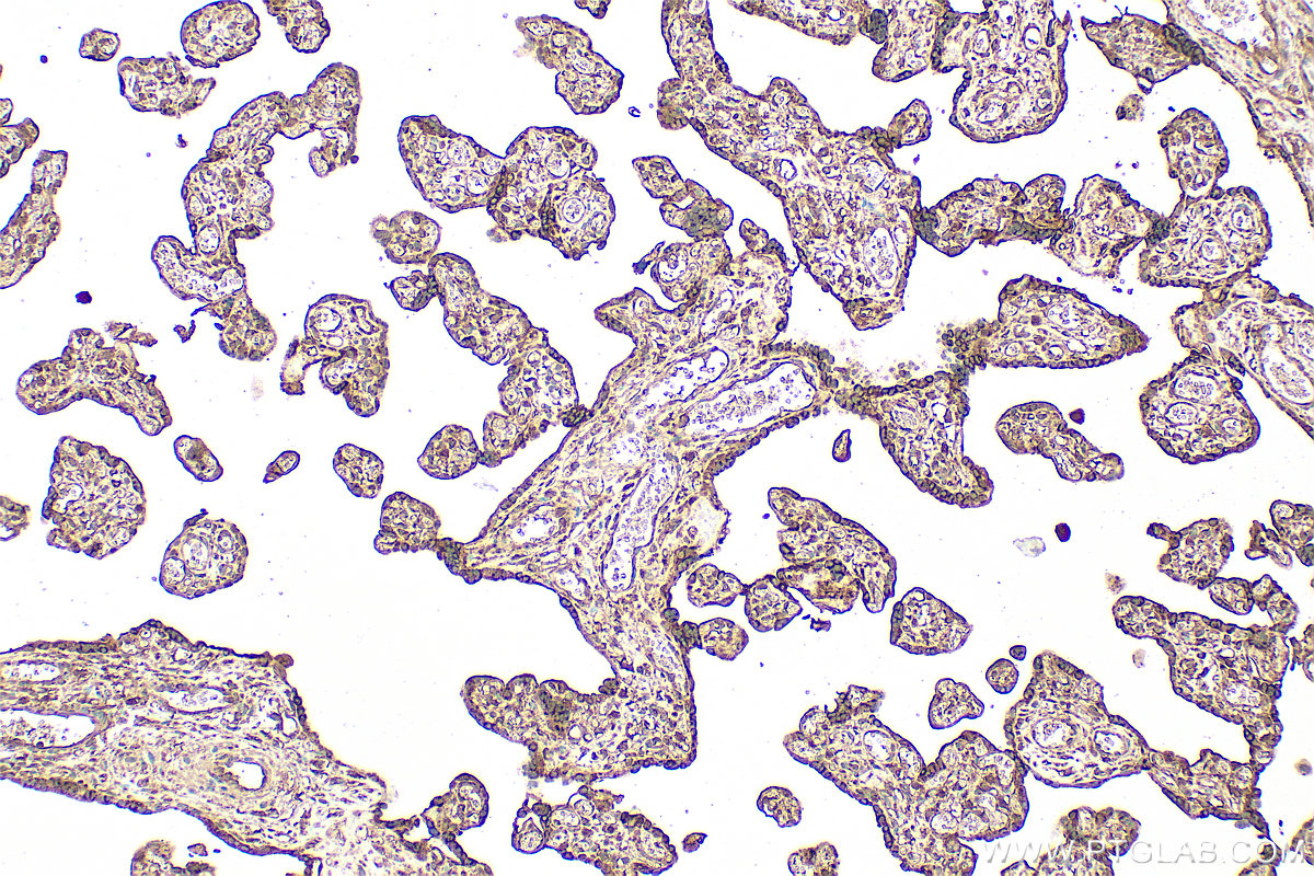 IHC staining of human placenta using 27905-1-AP (same clone as 27905-1-PBS)