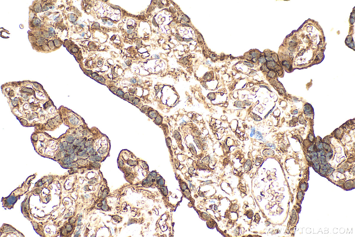 IHC staining of human placenta using 27905-1-AP (same clone as 27905-1-PBS)