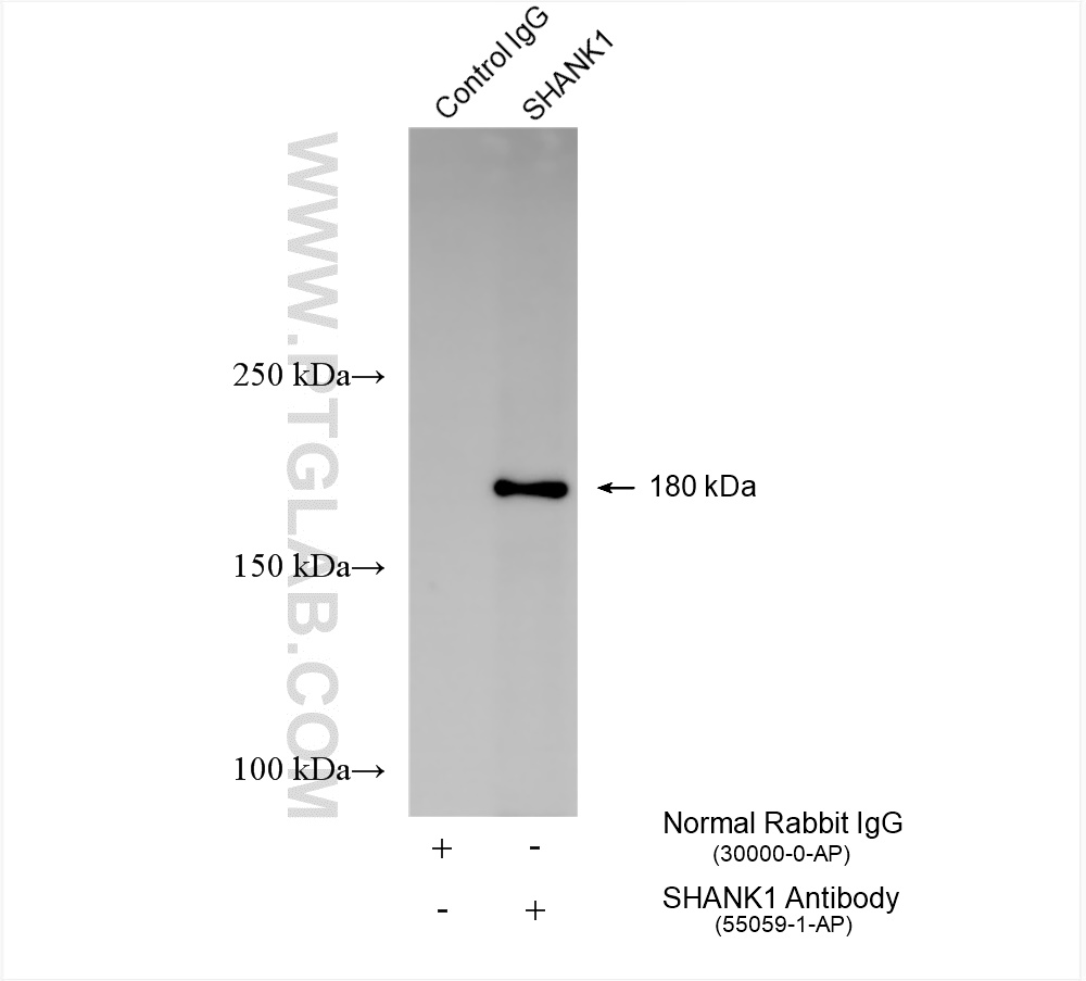 IP experiment of HEK-293T using 55059-1-AP