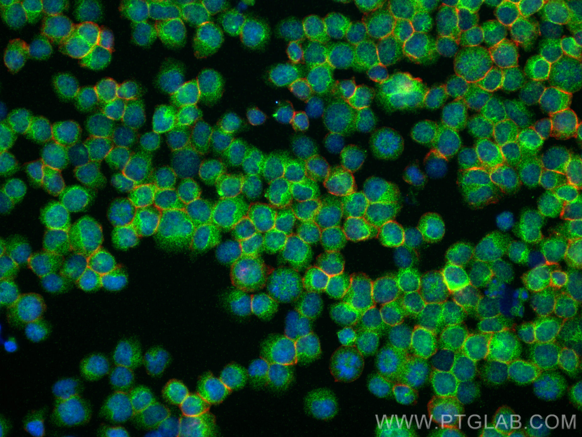 IF Staining of Jurkat using 14626-1-AP