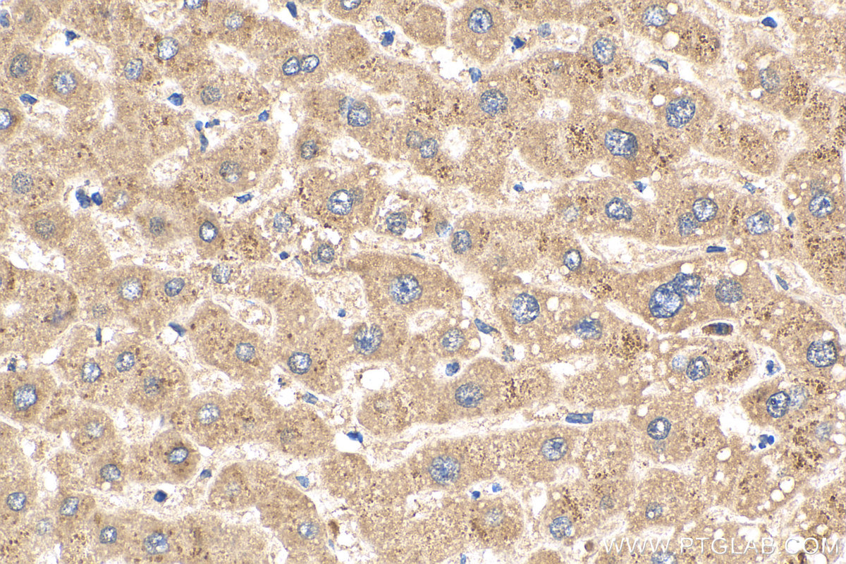 IHC staining of human liver using 18200-1-AP