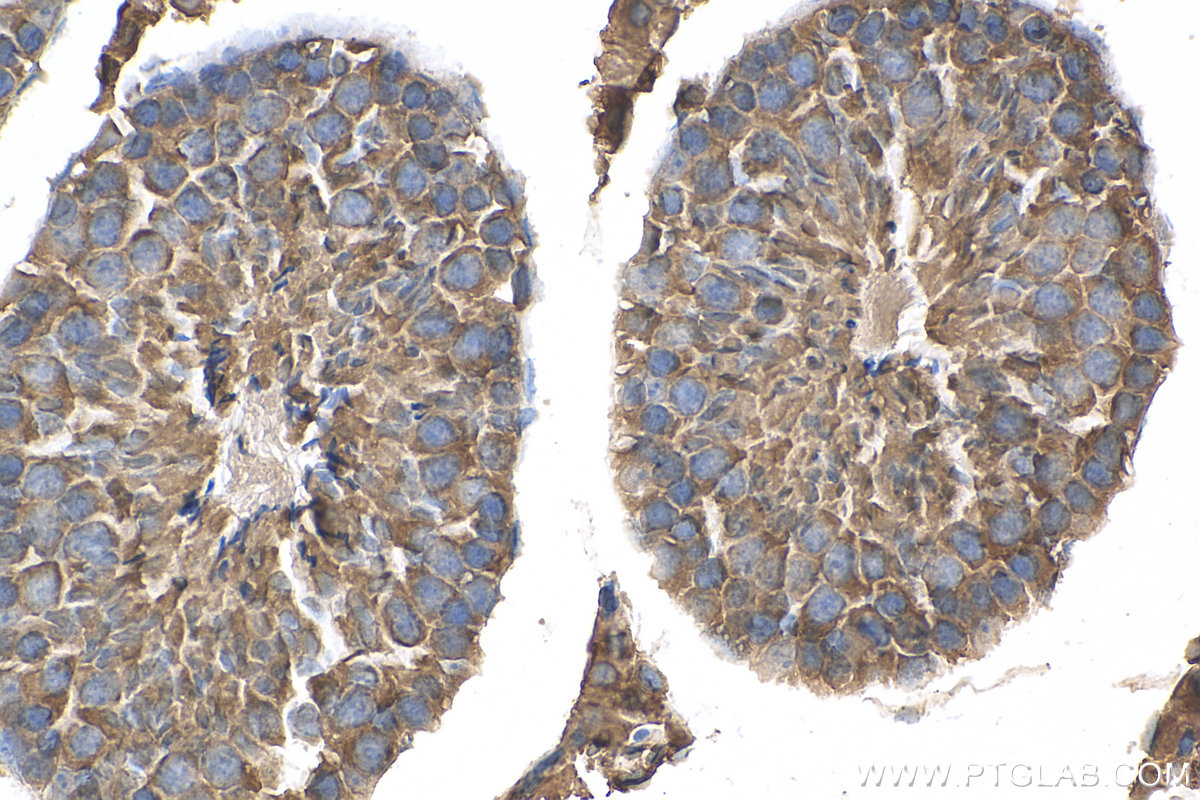 IHC staining of mouse testis using 18200-1-AP