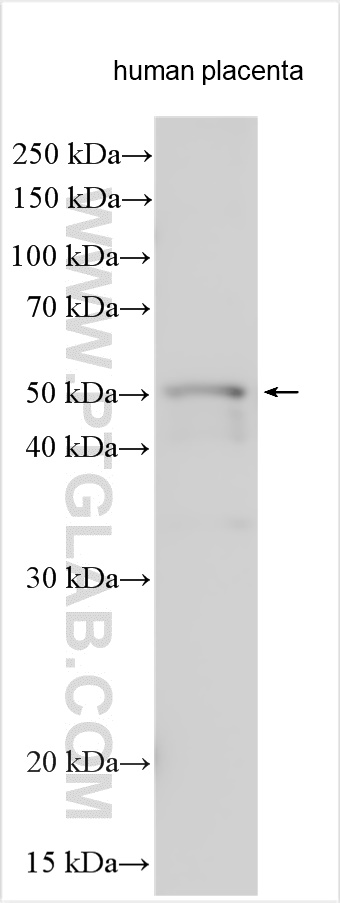 WB analysis of human placenta using 31025-1-AP