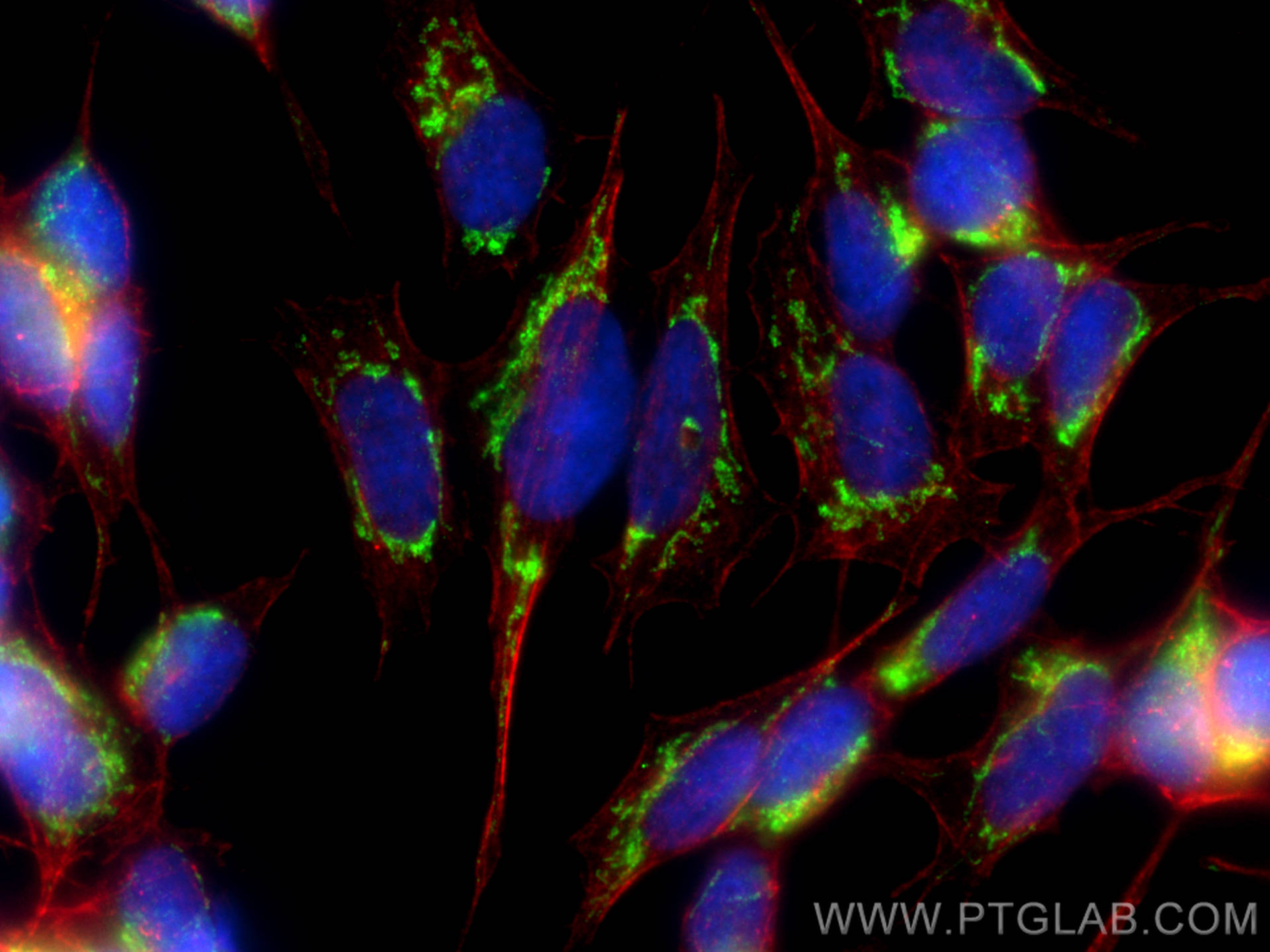 IF Staining of SH-SY5Y using 12641-1-AP