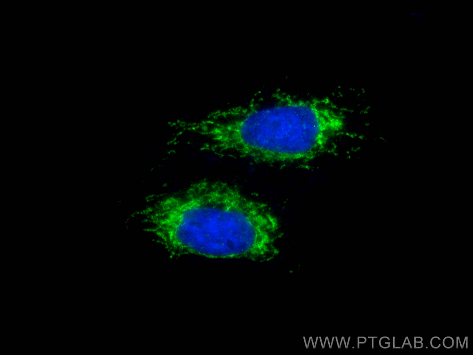 IF Staining of HepG2 using 12641-1-AP