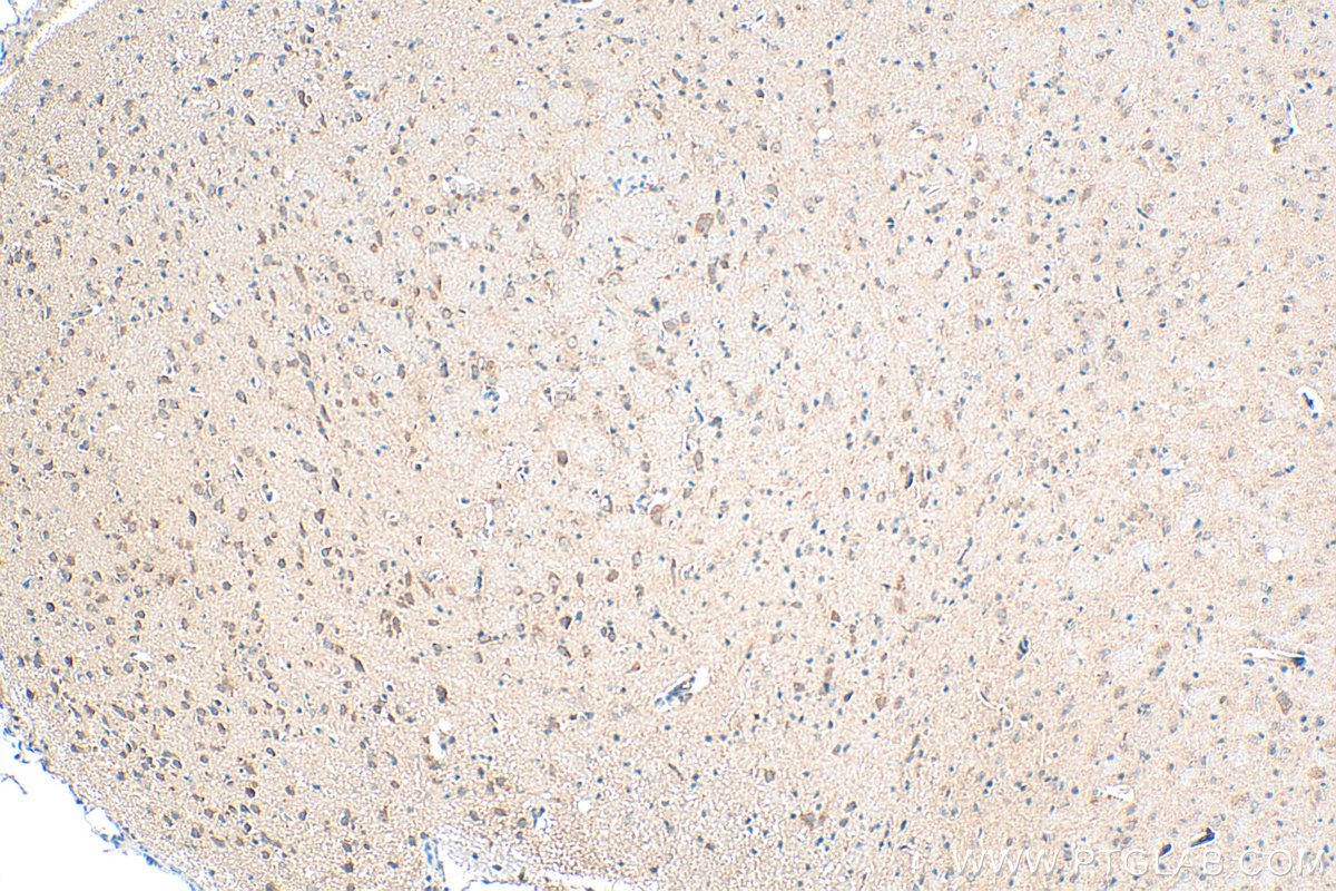 IHC staining of rat brain using 12641-1-AP