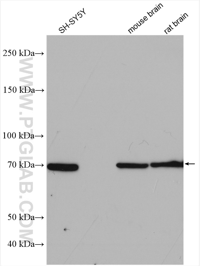 WB analysis using 12641-1-AP