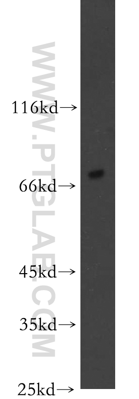 SHC4 Polyclonal antibody