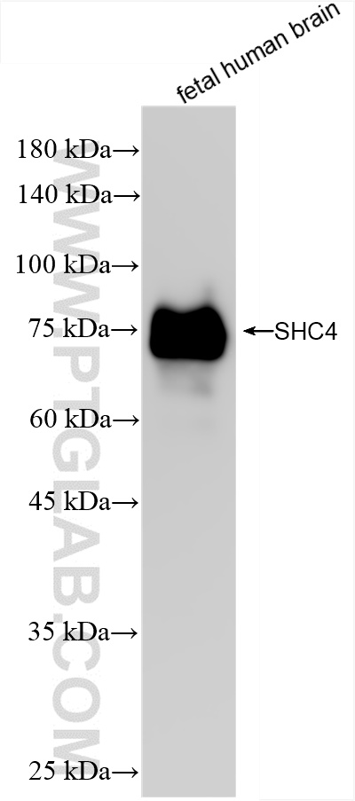 WB analysis of fetal human brain using 85181-4-RR (same clone as 85181-4-PBS)