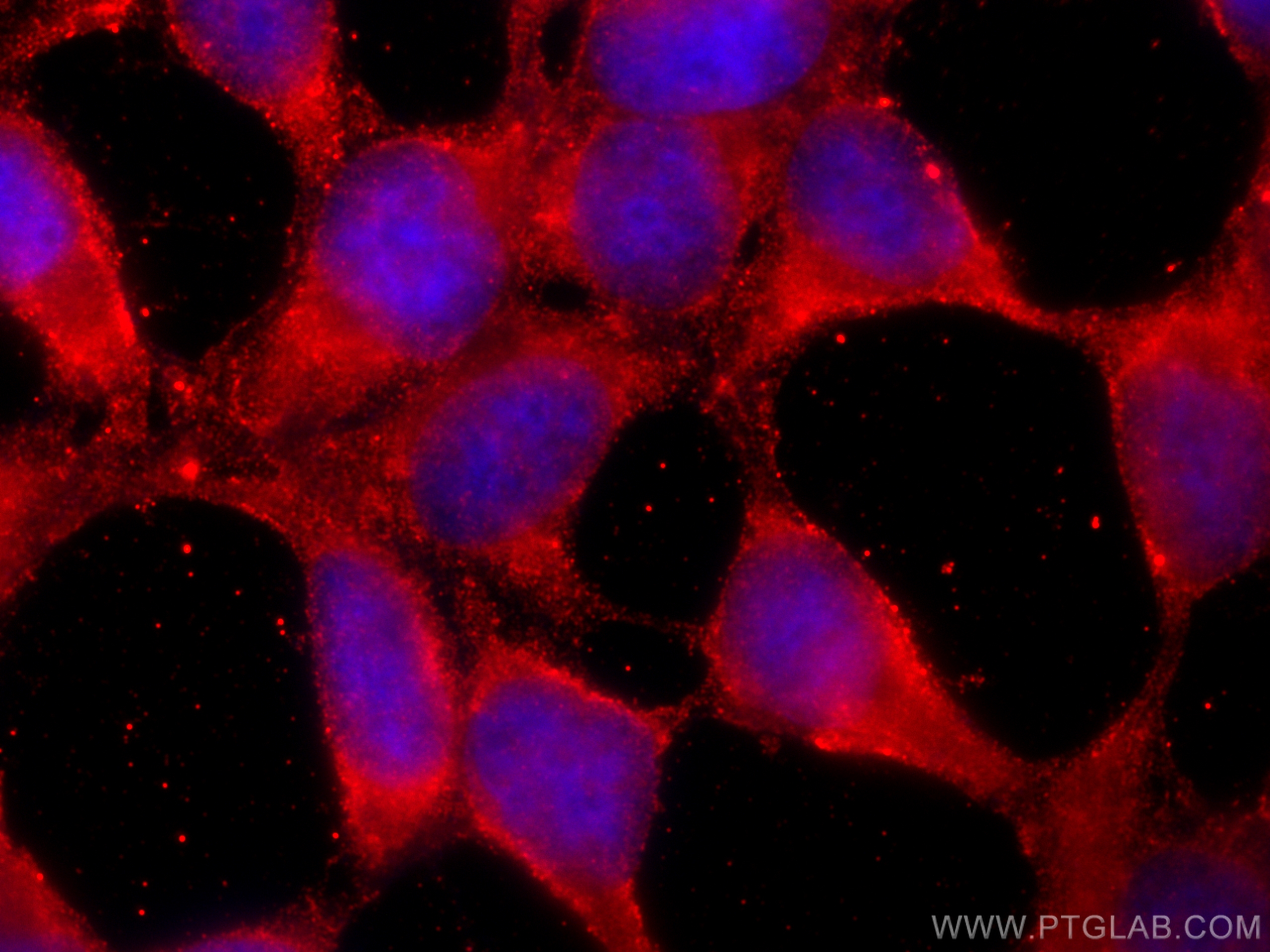 IF Staining of HEK-293 using 68647-1-Ig