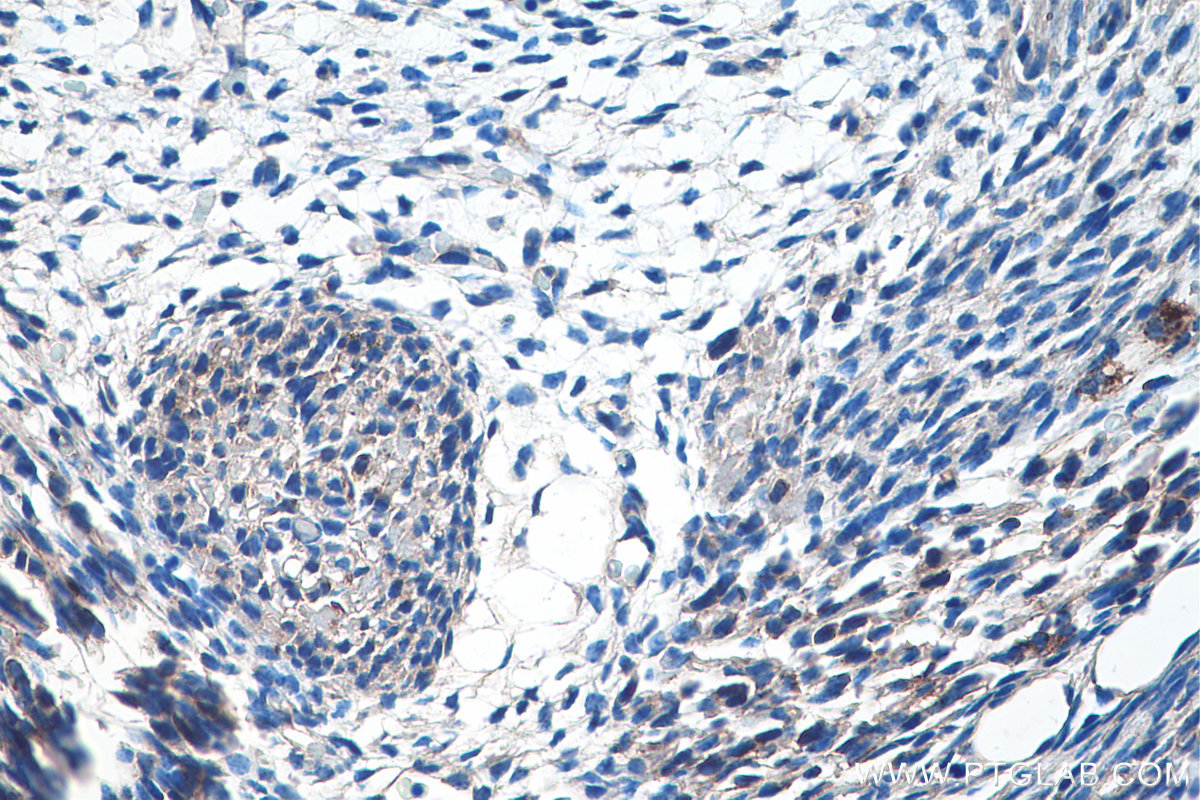 IHC staining of mouse embryo using 20697-1-AP