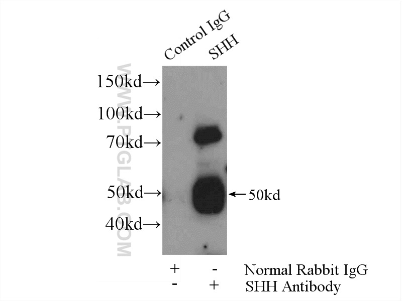 IP experiment of mouse liver using 20697-1-AP