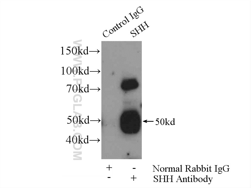 IP experiment of mouse liver using 20697-1-AP