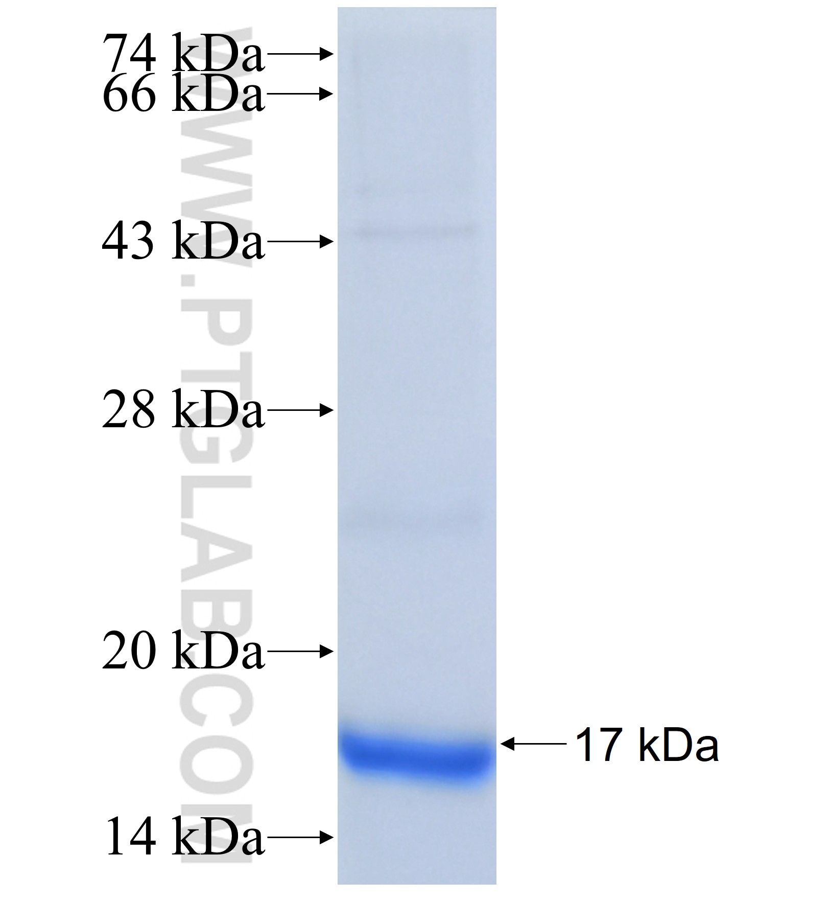 SHISA5 fusion protein Ag40848 SDS-PAGE SHISA5 fusion protein Ag40848 SDS-PAGE