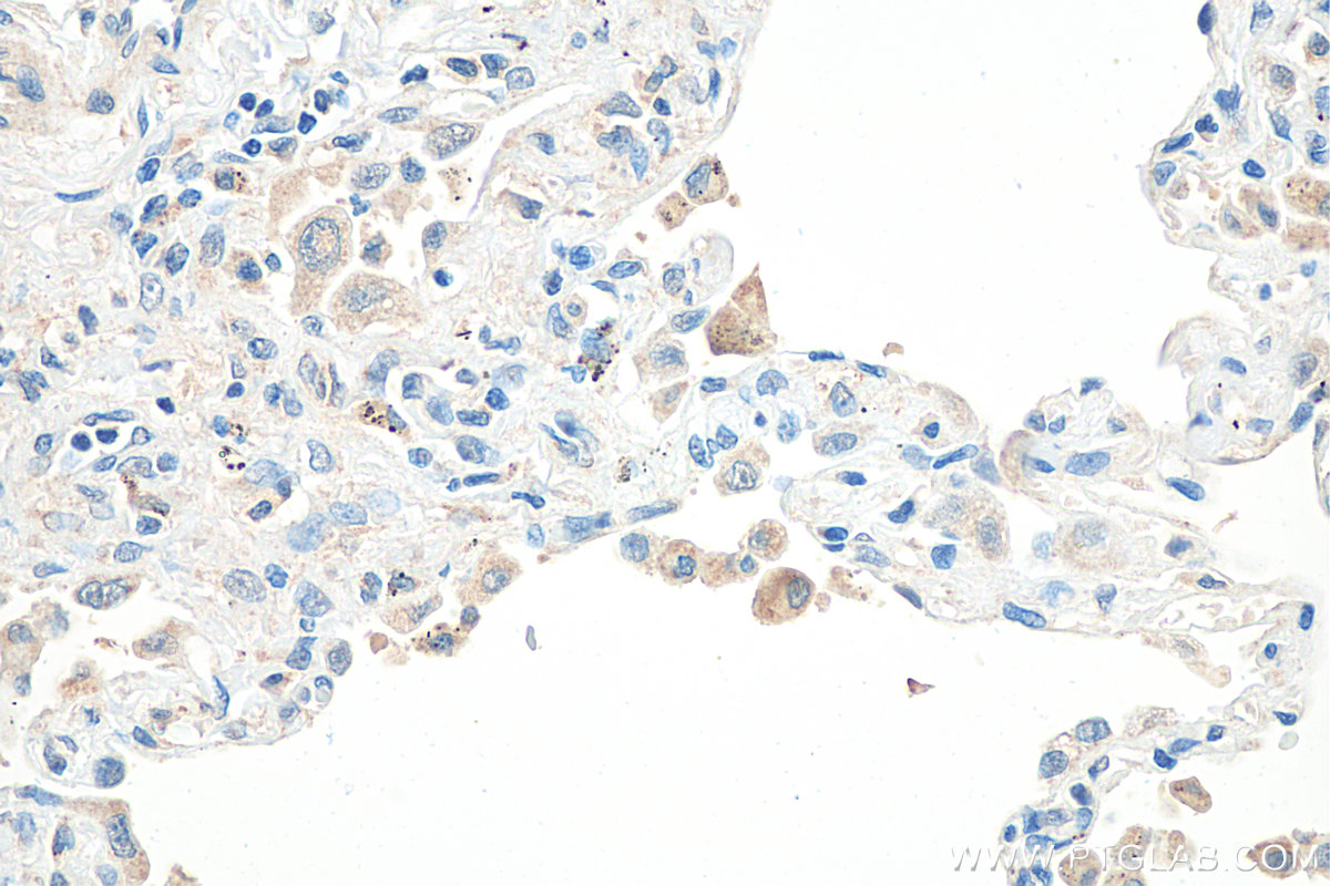 IHC staining of human lung using 30240-1-AP