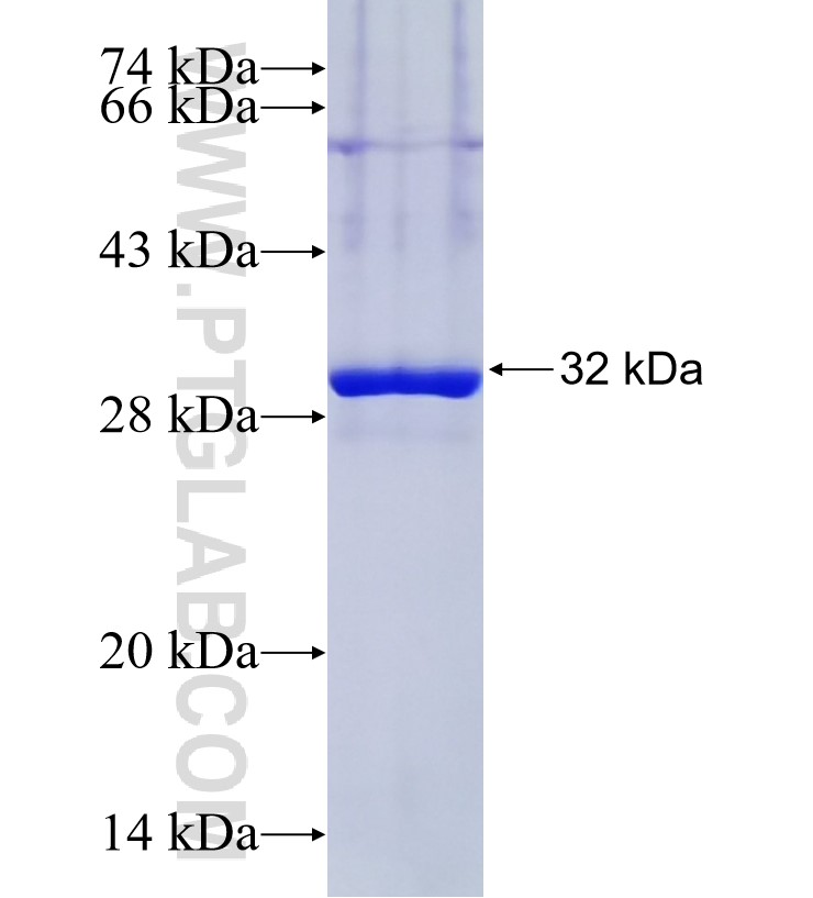 SHISA9 fusion protein Ag34681 SDS-PAGE SHISA9 fusion protein Ag34681 SDS-PAGE