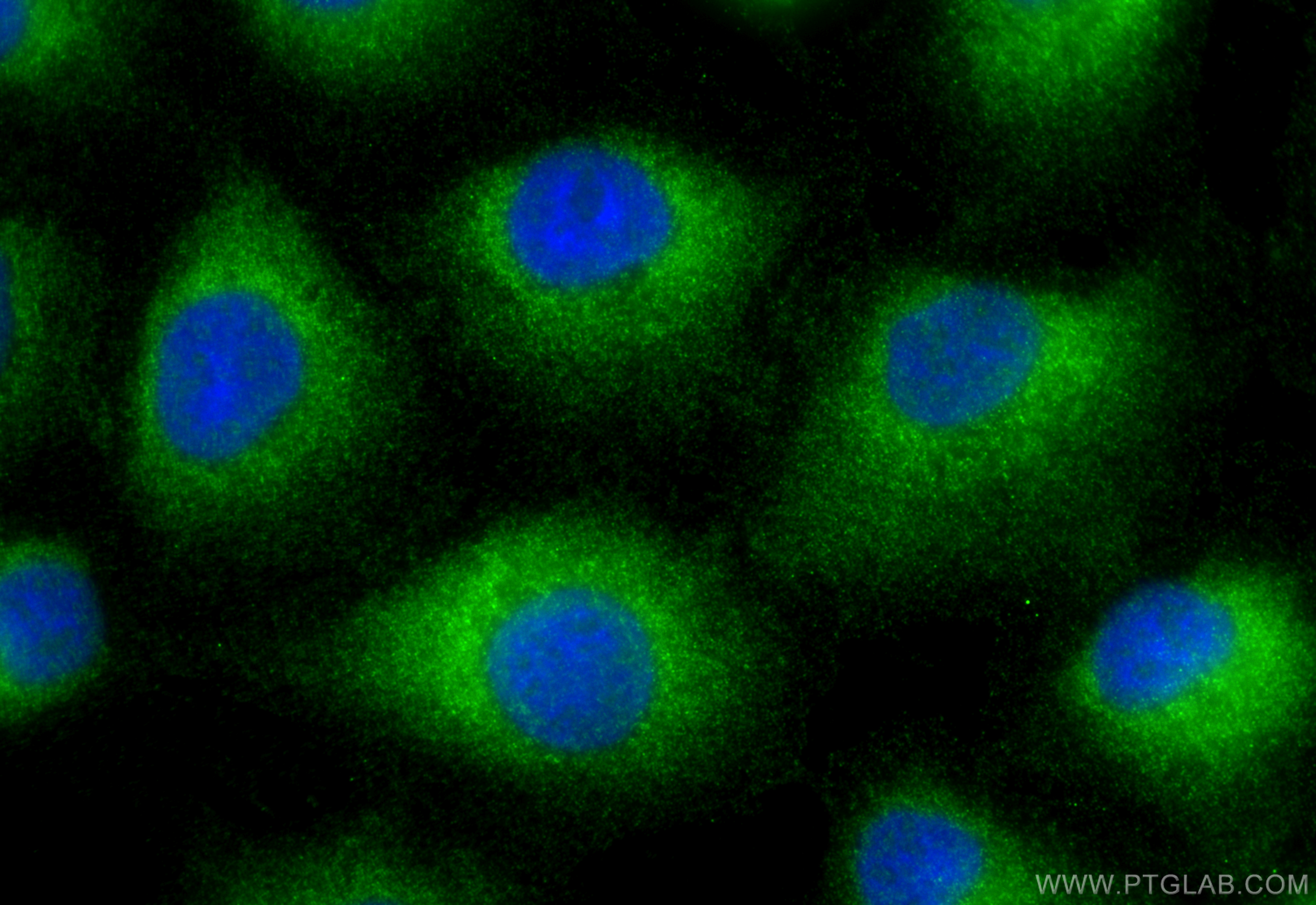 IF Staining of A549 using 12703-1-AP