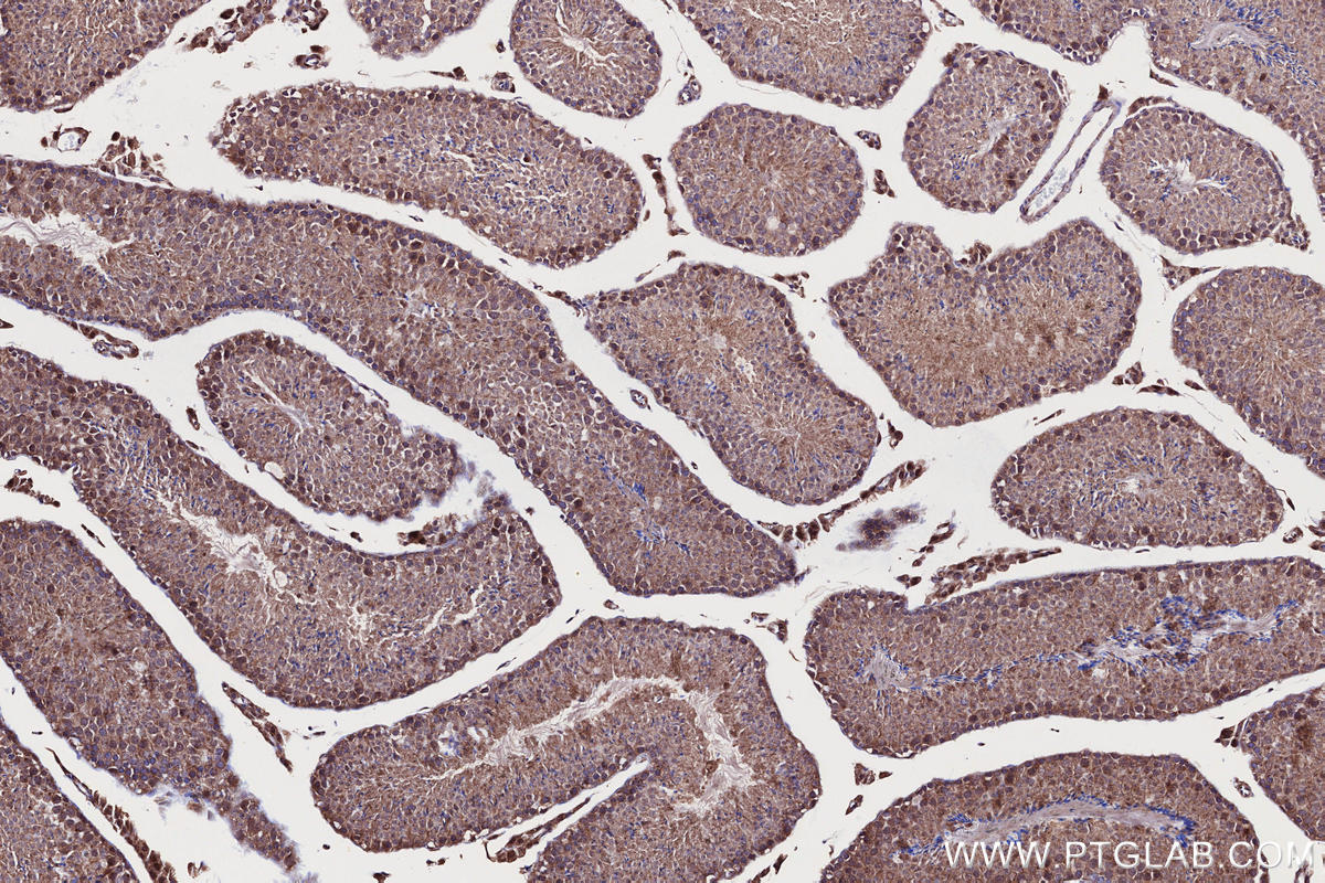 IHC staining of mouse testis using 12703-1-AP IHC staining of mouse testis using 12703-1-AP