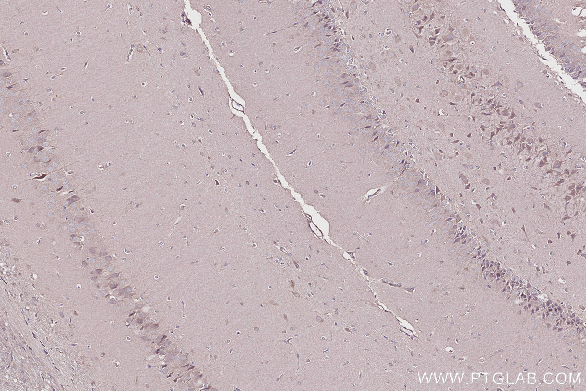 IHC staining of rat brain using 12703-1-AP IHC staining of rat brain using 12703-1-AP
