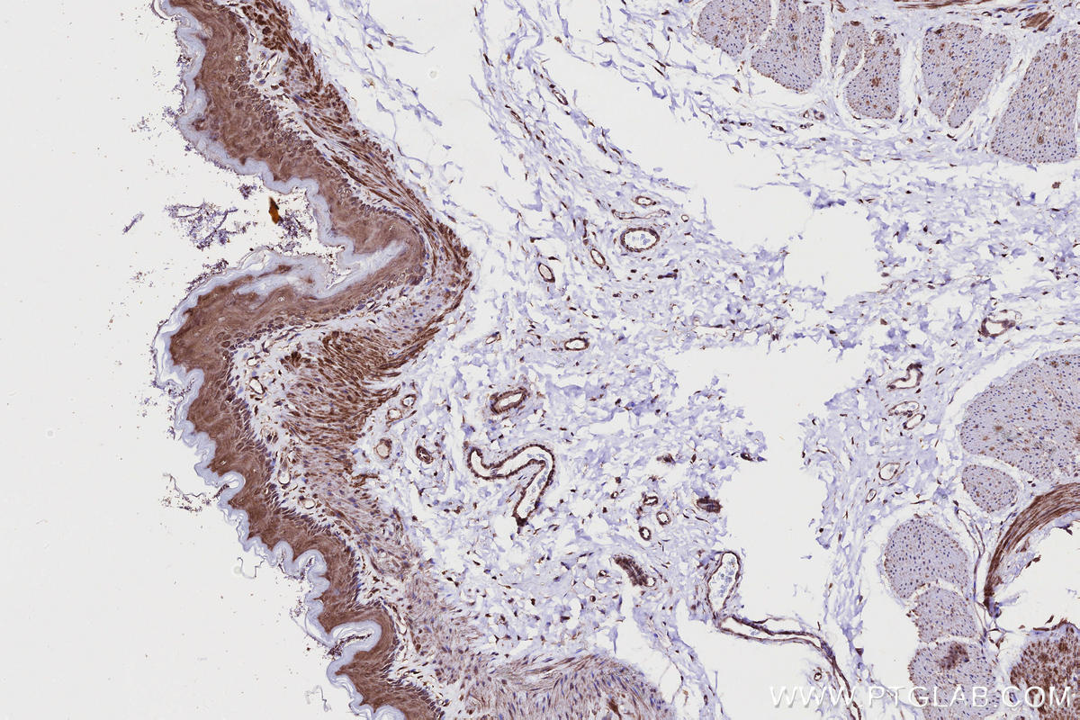 IHC staining of rat stomach using 12703-1-AP IHC staining of rat stomach using 12703-1-AP