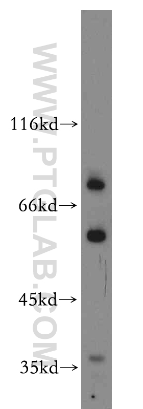 WB analysis of A431 using 12703-1-AP