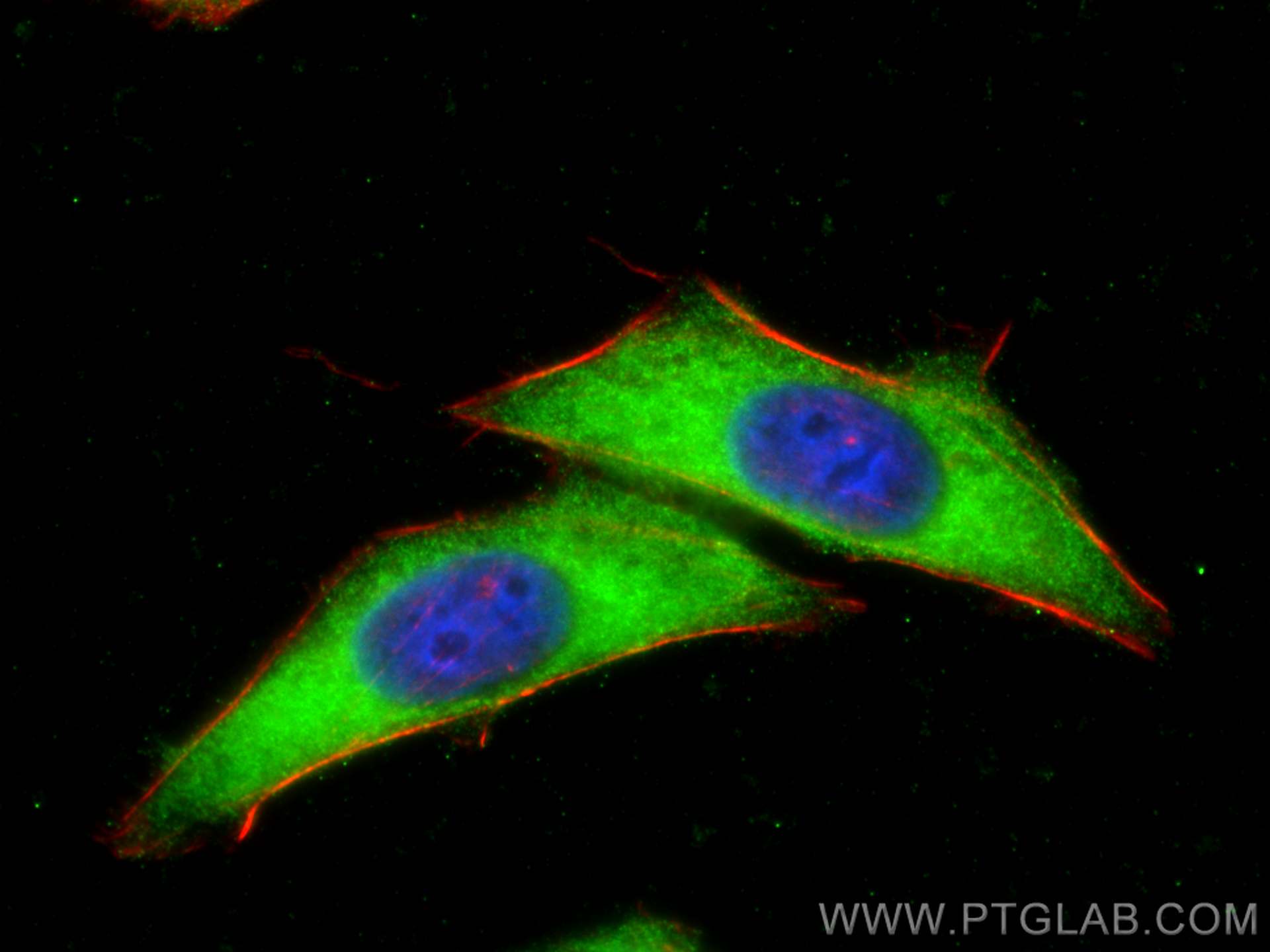 IF Staining of HepG2 using 30192-1-AP