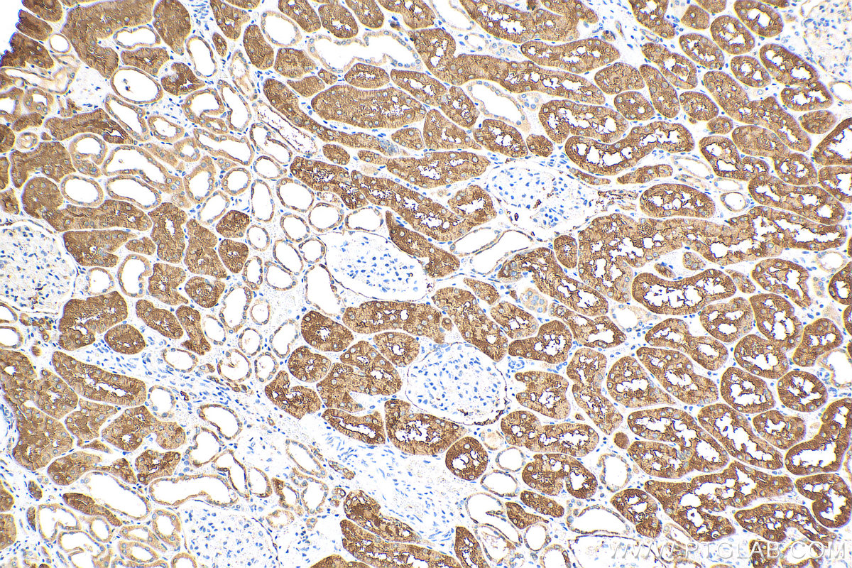 IHC staining of human kidney using 30192-1-AP