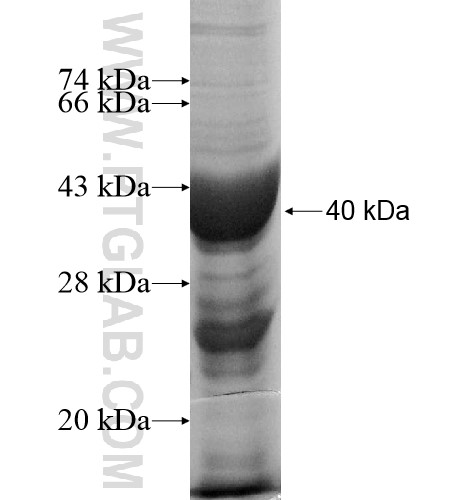 SHOC2 fusion protein Ag11665 SDS-PAGE SHOC2 fusion protein Ag11665 SDS-PAGE