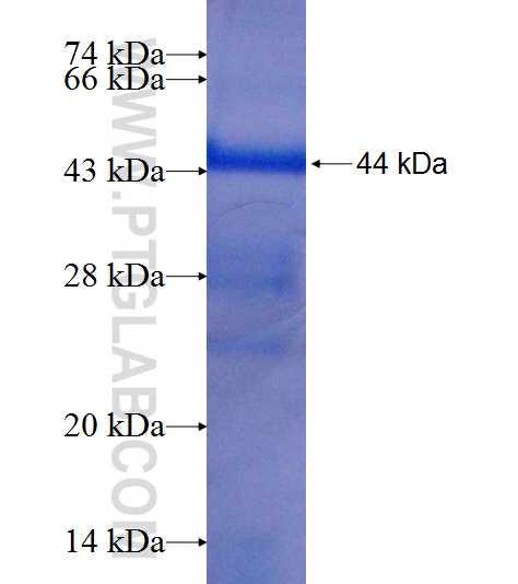 SHOX2 fusion protein Ag9156 SDS-PAGE