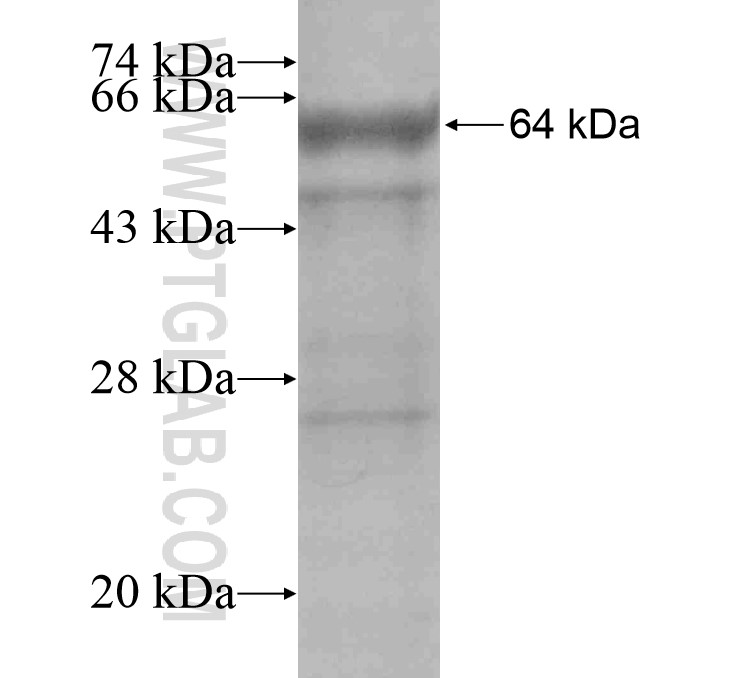 SHPRH fusion protein Ag16635 SDS-PAGE