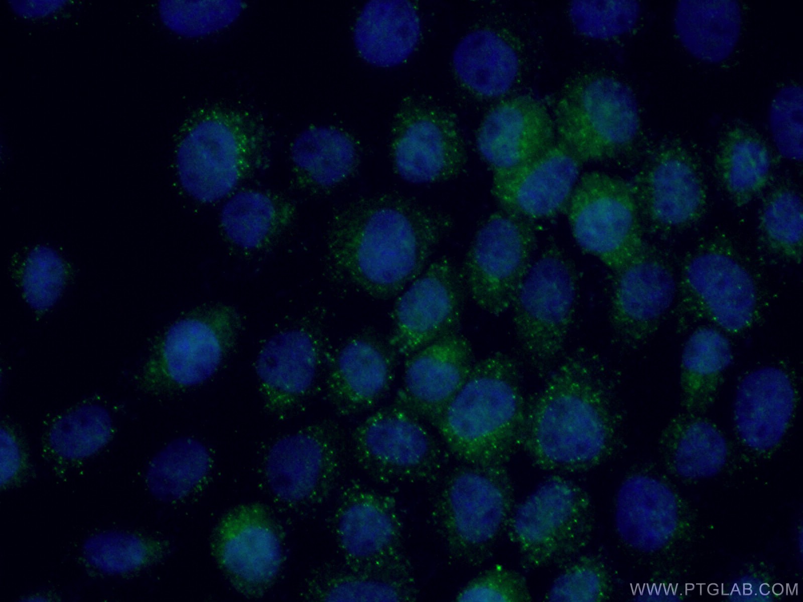 Immunofluorescent analysis of (4% PFA) fixed A431 cells using 27020-1-AP (SHQ1 antibody) at dilution of 1:50 and Alexa Fluor 488-Conjugated Goat Anti-Rabbit IgG(H+L). IF Staining of A431 using 27020-1-AP
