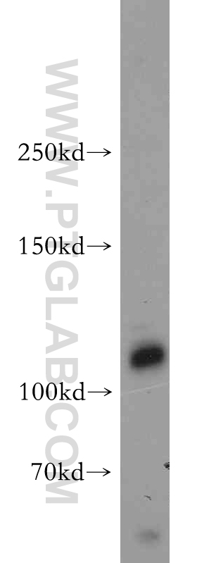 WB analysis of MCF-7 using 18218-1-AP