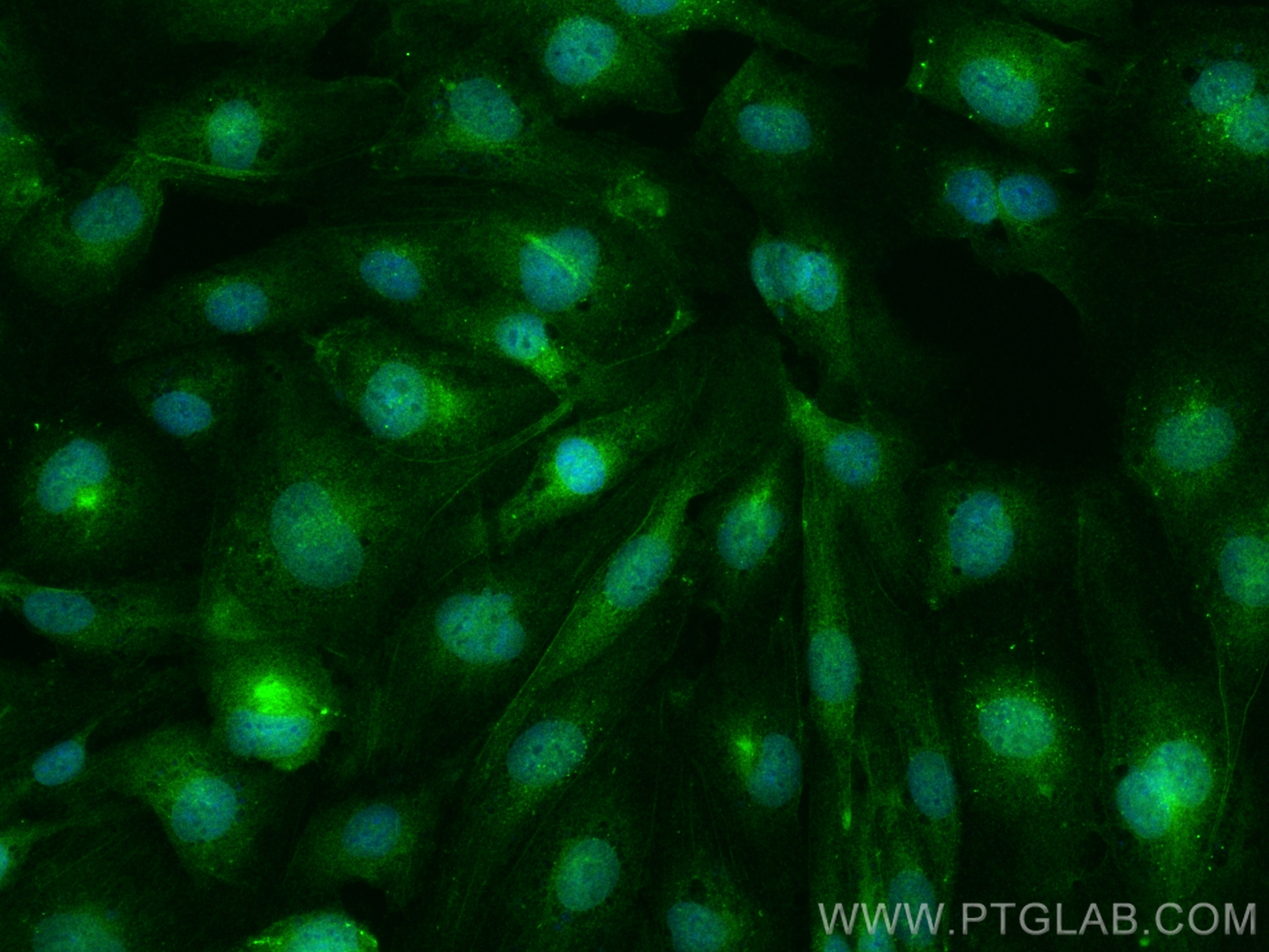 IF Staining of HUVEC using 31712-1-AP