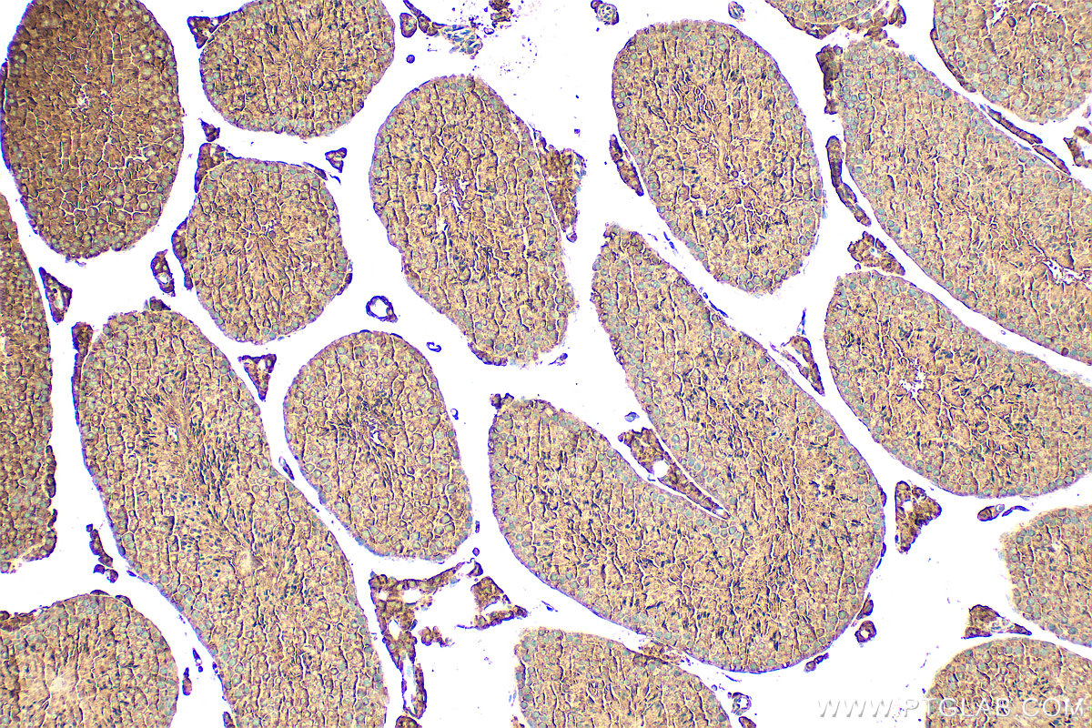 IHC staining of mouse testis using 31712-1-AP